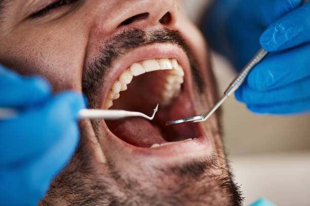Oral Cancer Screening in Hildebran, NC